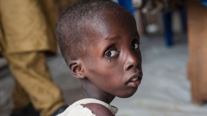 Nigeria Boko Haram: Children starving, warns Unicef