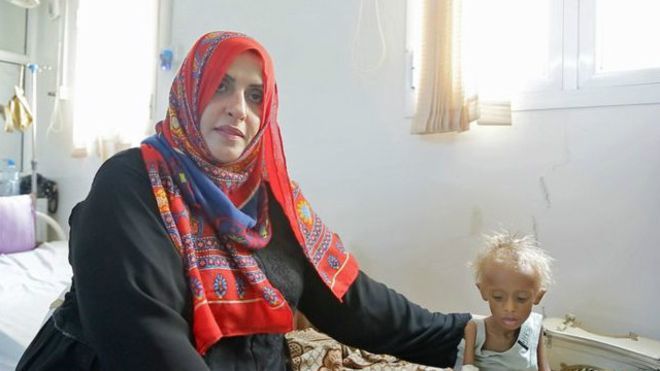السيدة التي تحارب المجاعة منفردة في اليمن