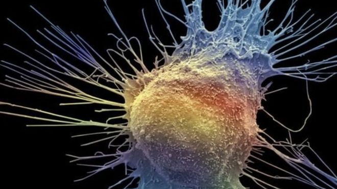 علاج لسرطان البروستاتا "يمكن أن يساعد المزيد من المرضى"