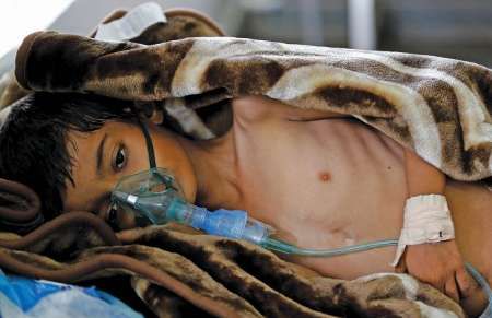 تقرير إرنا عن الكارثة الإنسانية في اليمن