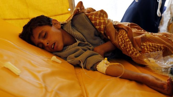 ВОЗ: число жертв эпидемии холеры в Йемене достигло 1500 человек