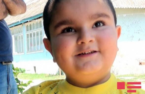 В азербайджанском Лянкяране живет мальчик с 7 пальцами на руке