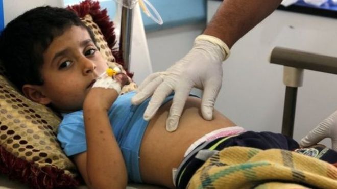 الصليب الأحمر يحذر من إصابة 600 ألف يمني بالكوليرا هذا العام