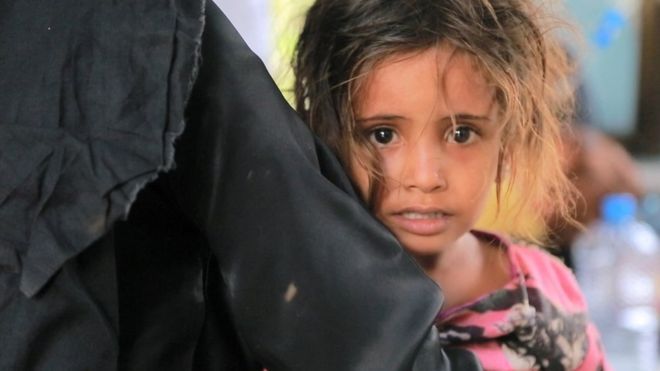 اليمن: وباء الحرب - وثائقي جديد من بي بي سي صور