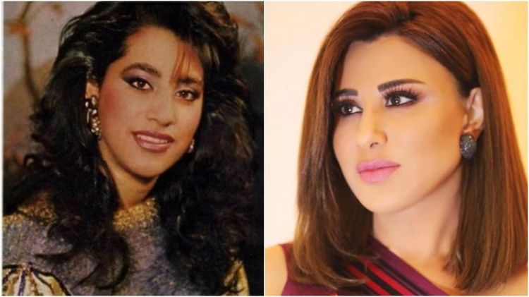 عمليات تجميل النجمات العرب...هذا هو الفرق في جمالهن!