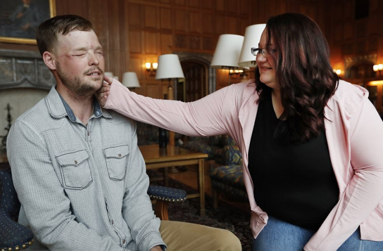 В США вдова увиделась с мужчиной, которому пересадили лицо её мужа