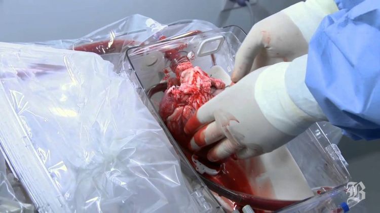 50 лет первой трансплантации сердца в мире