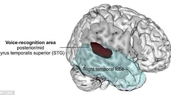 اكتشاف المنطقة بالدماغ المسؤولة عن تمييز الأصوات