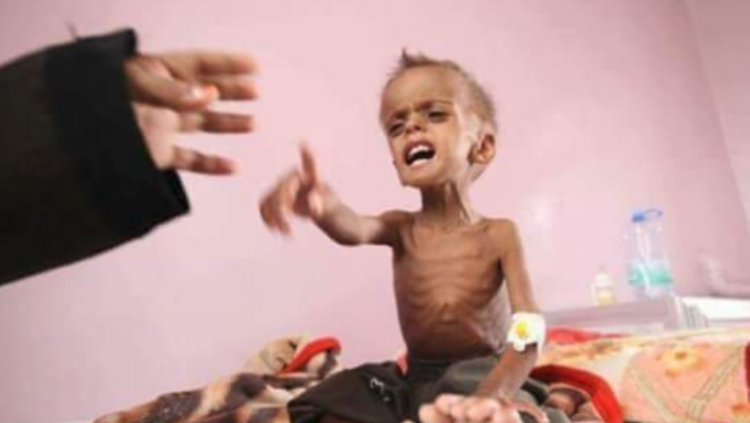 مقال بمجلة أمريكية: السعودية والامارات تقتلان اليمنيين جوعا
