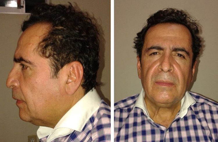 Mexican drug lord, Beltran Leyva, dead at 56 of cardiac arrest