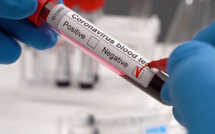 В Азербайджане пока нет вероятности повторного массового заражения коронавирусом инфекционист
