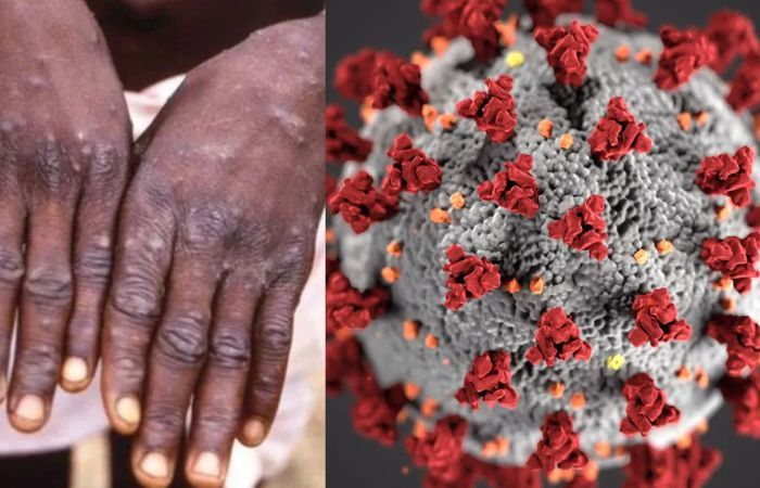 Monkeypox scare grips India after 8 cases, 1 death