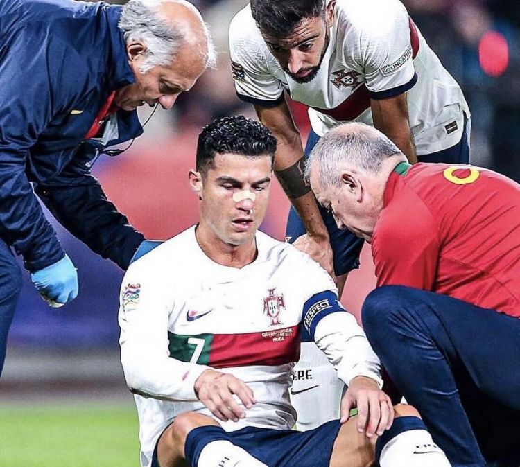 Rəqib qapıçı Ronaldonun burnunu əzdi