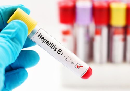 Döymə hepatitə yoluxdurur Həkimlərdən virusla bağlı XƏBƏRDARLIQ