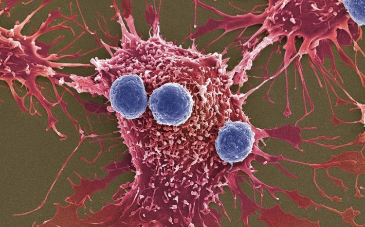 Ученые научили раковые клетки бороться с самой опухолью