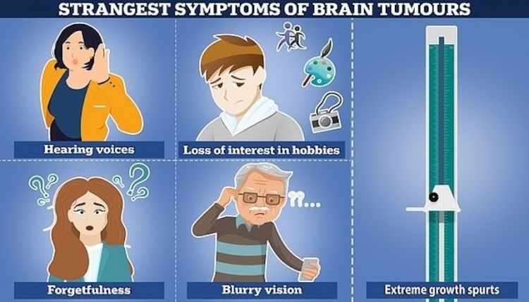 أعراض غريبة لأورام الدماغ