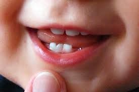 Uşaqlar 3 aylığında da diş çıxara bilər? Mütəxəssisdən MARAQLI AÇIQLAMA