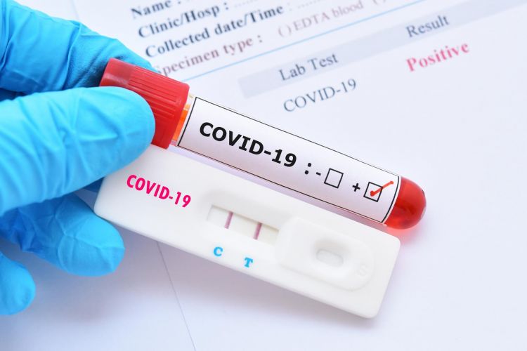 Azerbaijan confirms 10 more COVID-19 cases