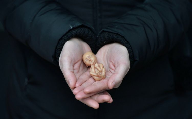 15-19 yaş qrupları arasında 2000-dən çox abort qeydə ALINIB