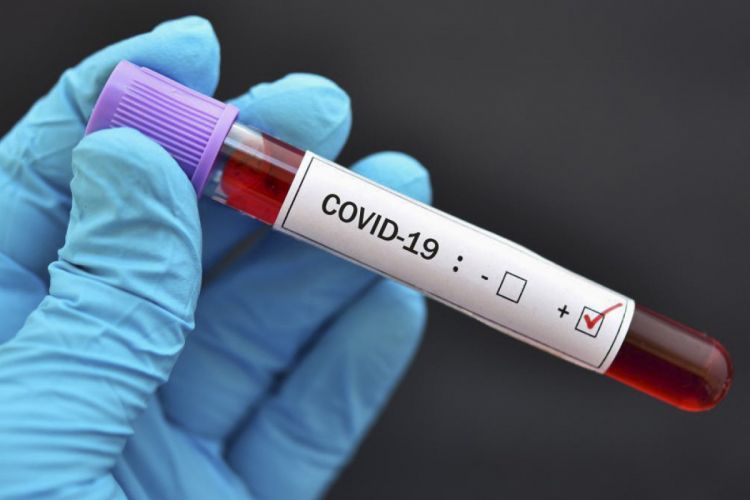 WHO: Number of COVID-19 cases in the last 28-day period increased by 63%